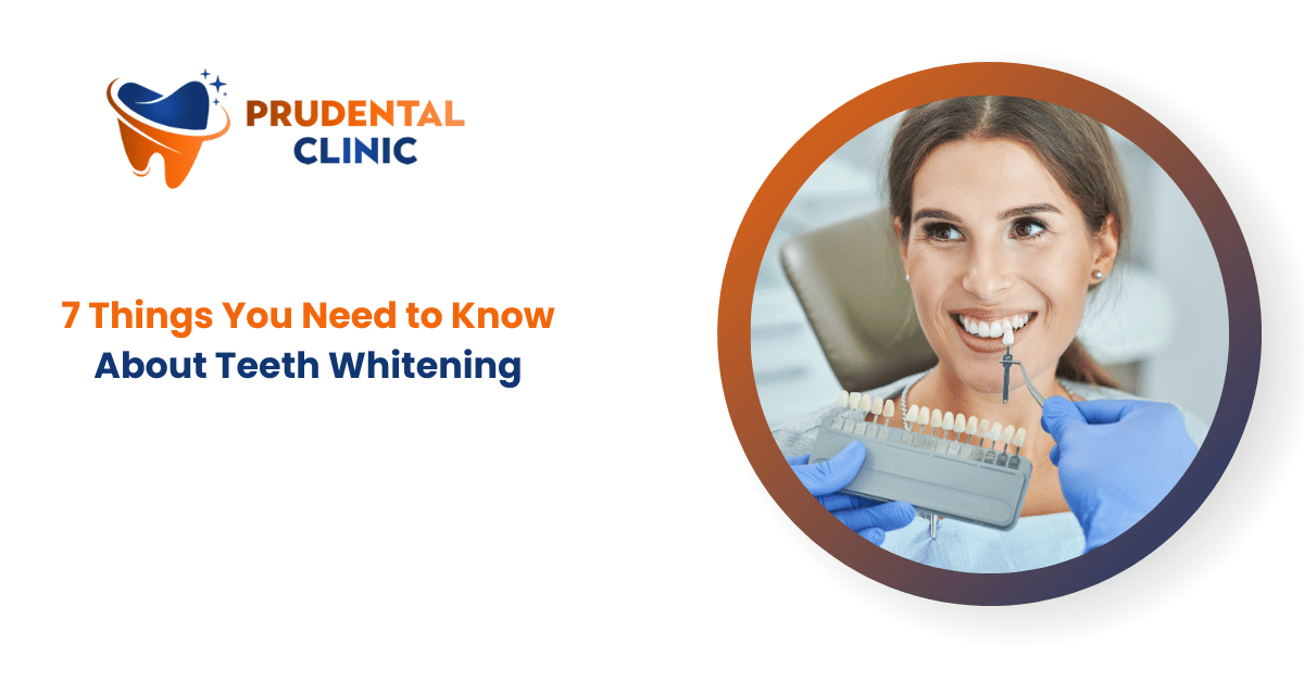 7 Things You Need to Know About Teeth Whitening