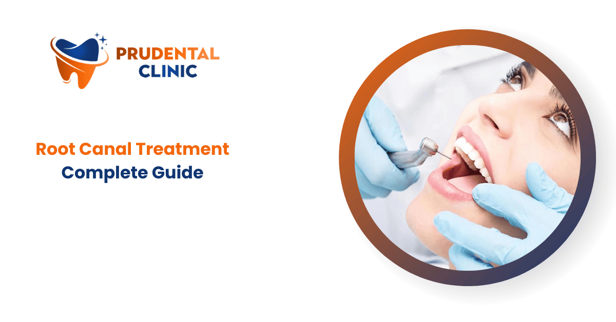 Root Canal Treatment - Complete Guide