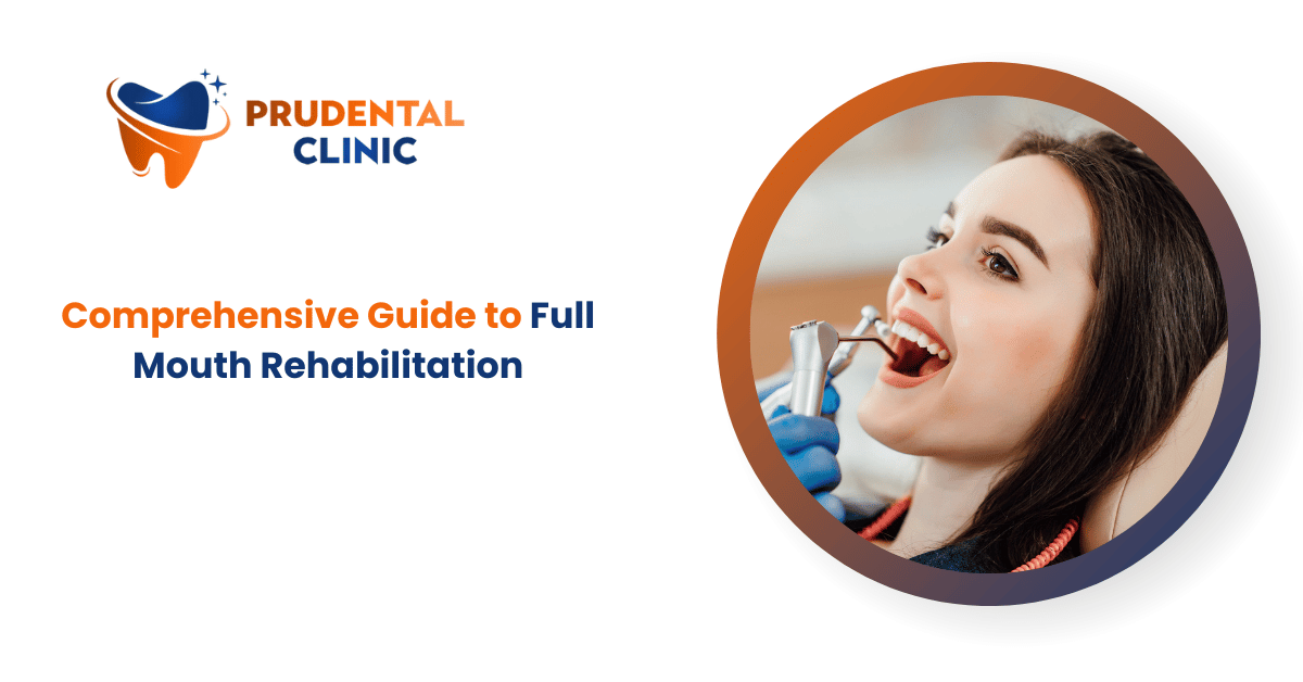 Comprehensive Guide to Full Mouth Rehabilitation