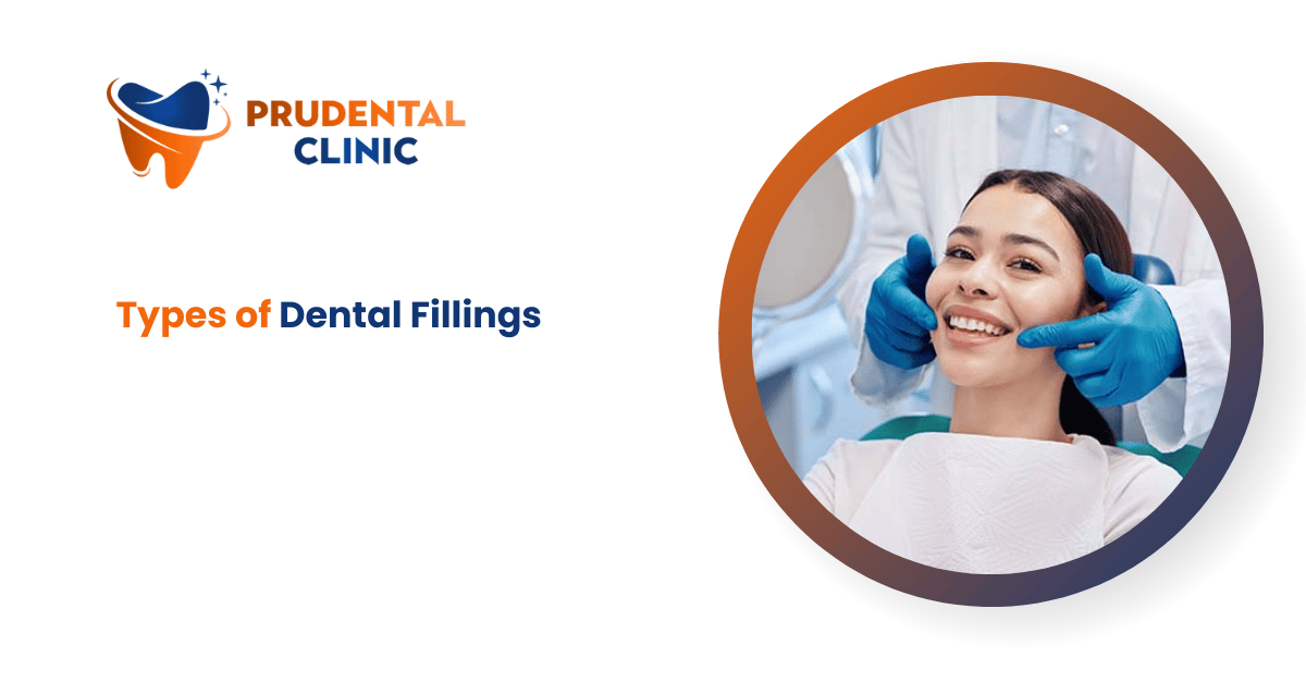 Types of Dental Fillings